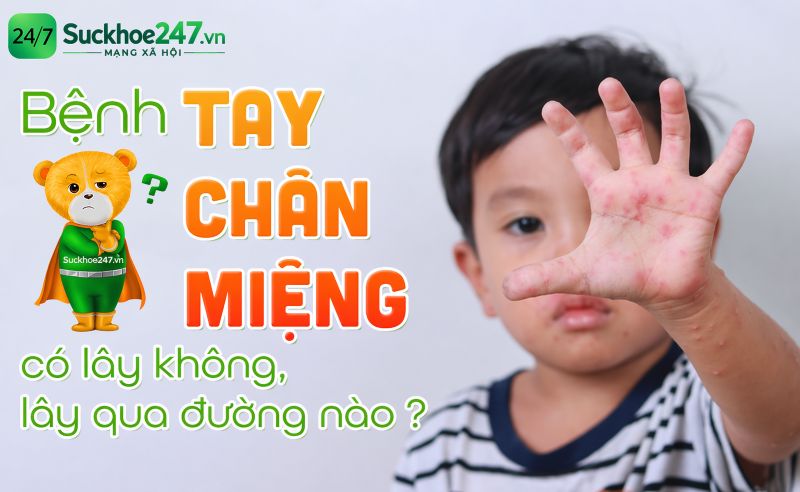 Vì sao bệnh tay chân miệng tăng mạnh ở trẻ mầm non vào đầu tuần?